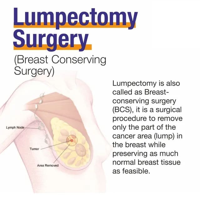 Breast-conserving-surgery-in-thane