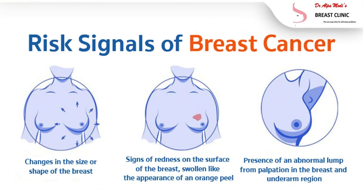 Risk-Signals-of-breast-cancer-in-thane