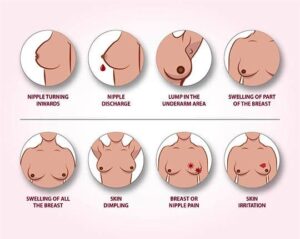Breast-cancer-surgeon-in-thane